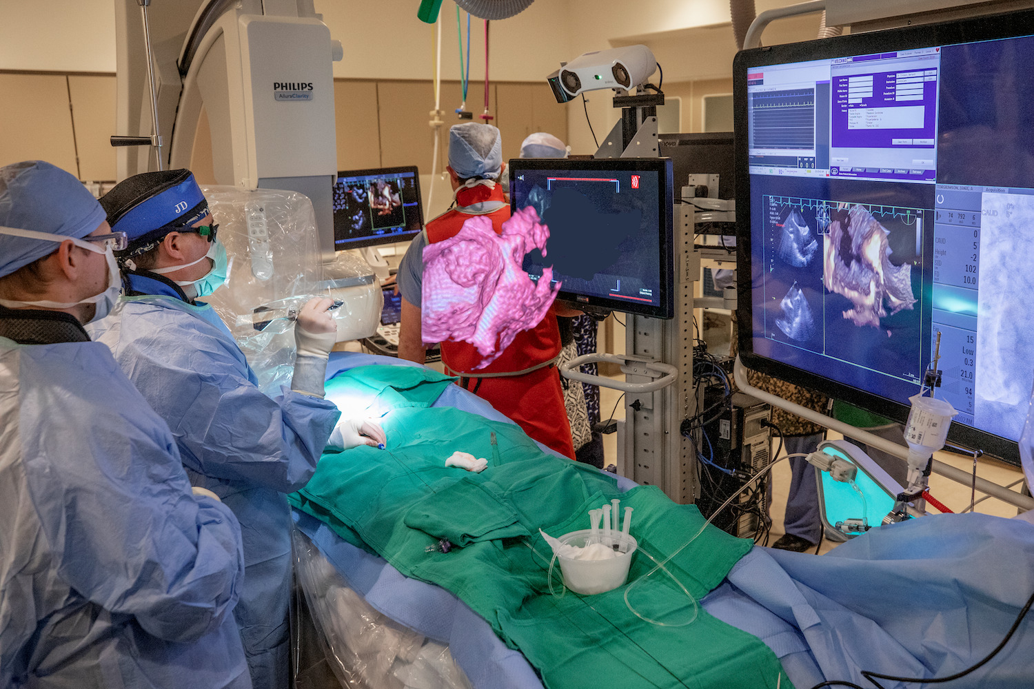 Photo of 4D hologram technology in cardiac surgery