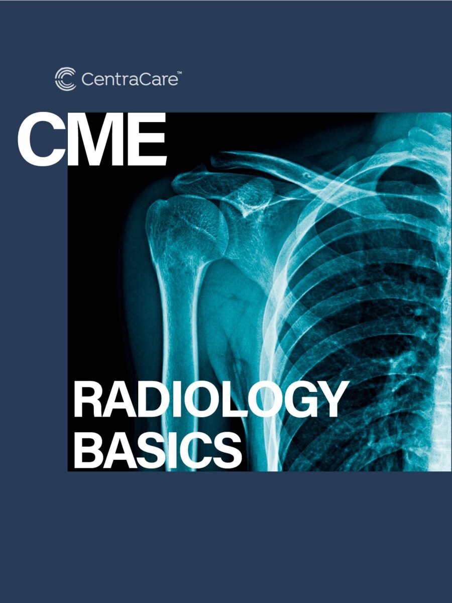 X-Ray image of a human shoulder and rib cage, promoting the January CME topic of Radiology Basics