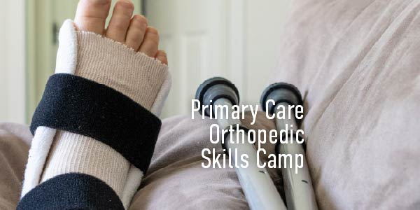 Photo of foot and ankle in a splint propped up on a couch next to crutches